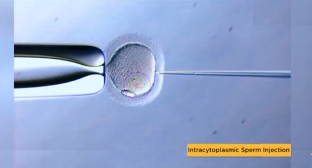 ivf treatment cost in Indore