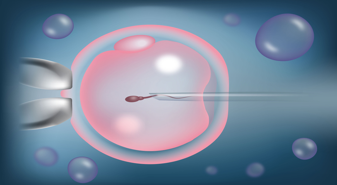 Micro Manipulation ICSI – Intracytoplasmic Sperm Injection